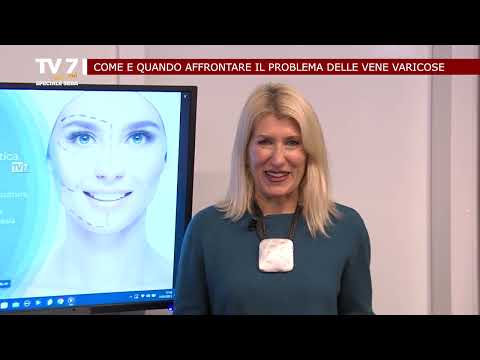 TV7 CON VOI SPECIALE SERA DEL 31/1/23 (3 di 6) - Il problema delle vene varicose