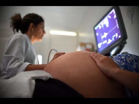 Audiência conjunta (CMULHER e CSSF) - Proteção Integral do Nascituro - PL 434/2021 - 08/10/2021