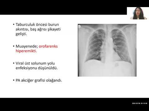 Türkiye EKMUD Batı Karadeniz Günleri, 8 Şubat 2024