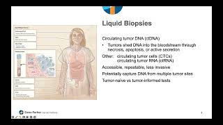 Liquid Biopsy for Esophageal Cancer | Dana-Farber Cancer Institute