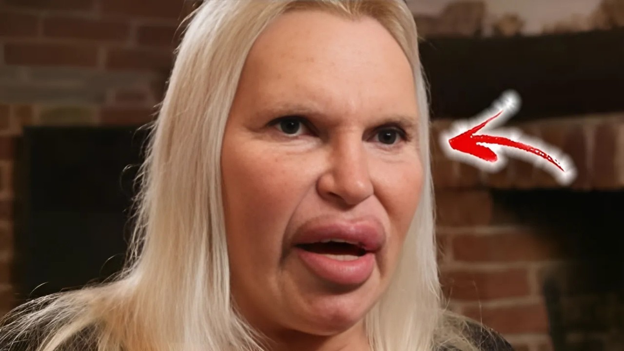 He Was a Famous Actor Before His Plastic Surgery, Guess Who  Then & Now 2025