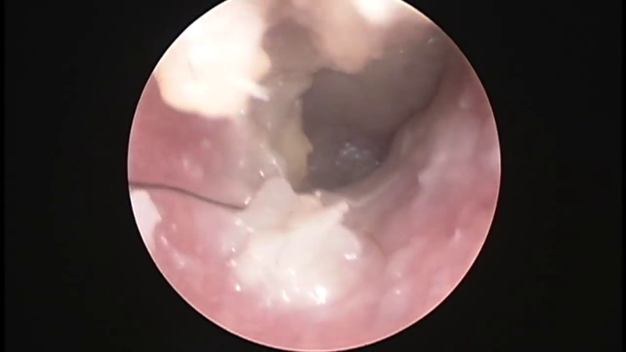 Joaquín Archibaldo Hope Guerrero-15