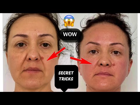 SECRET Massage for Heavy NASOLABIAL FOLDS | THE BEST FROM MASSAGE 🔥| Do it with me