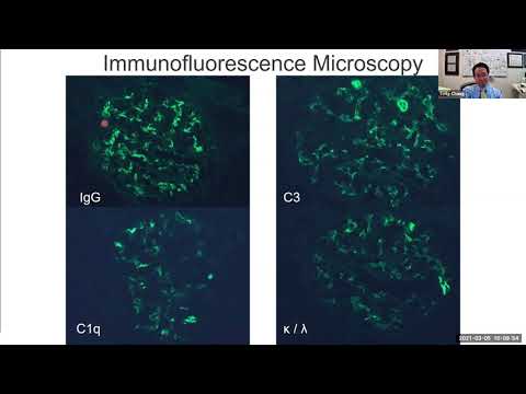 The pathology of lupus nephritis (5 Mar 2021)
