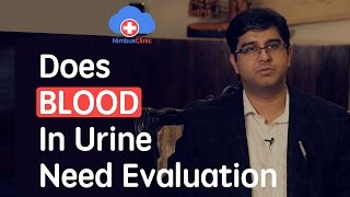 Does blood in urine need evaluation