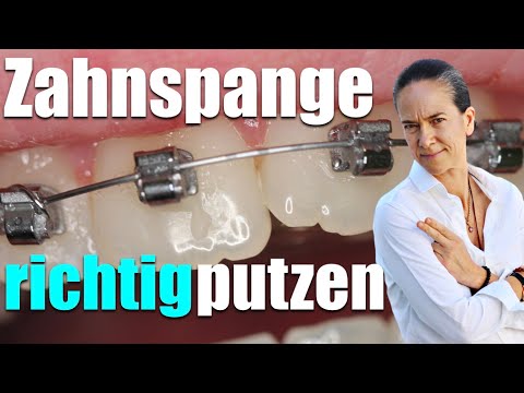 feste Zahnspange RICHTIG putzen: FATALE FEHLER