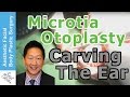 Microtia Ear Congenital Anomaly Otoplasty Surgery Live Carving of the Ear Graft by Dr Young  Seattle