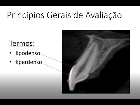 Introdução a Tomografia Computadorizada (Parte 2 de 3)