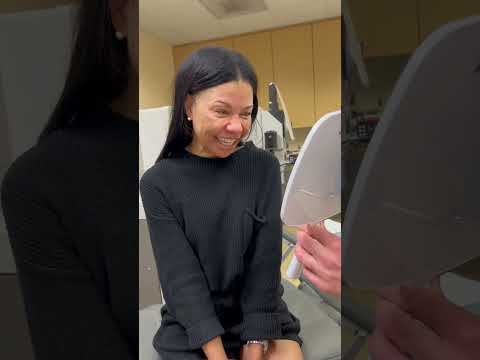 New Permanent Eye Color - Honey Gold, Low Intensity