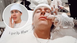 i got LIP FILLERS & this is what happened.. (ft flawlesscosmetic)