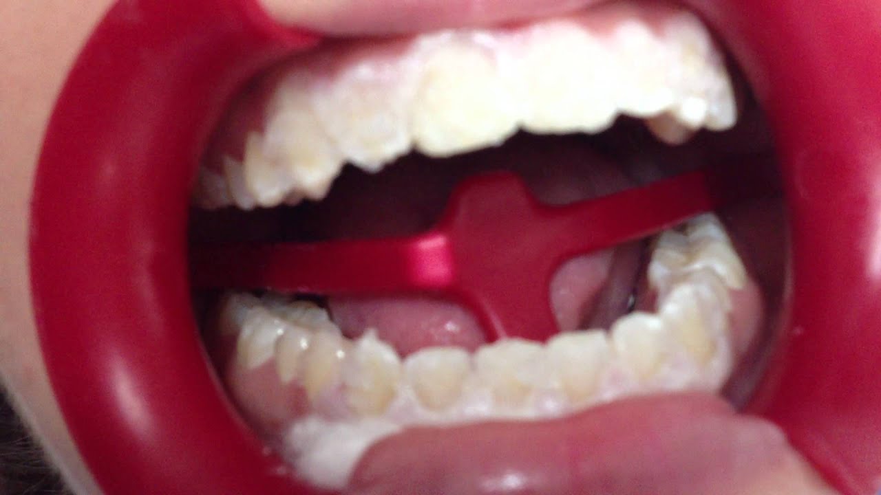 Concepción Carrillo Ramos-8