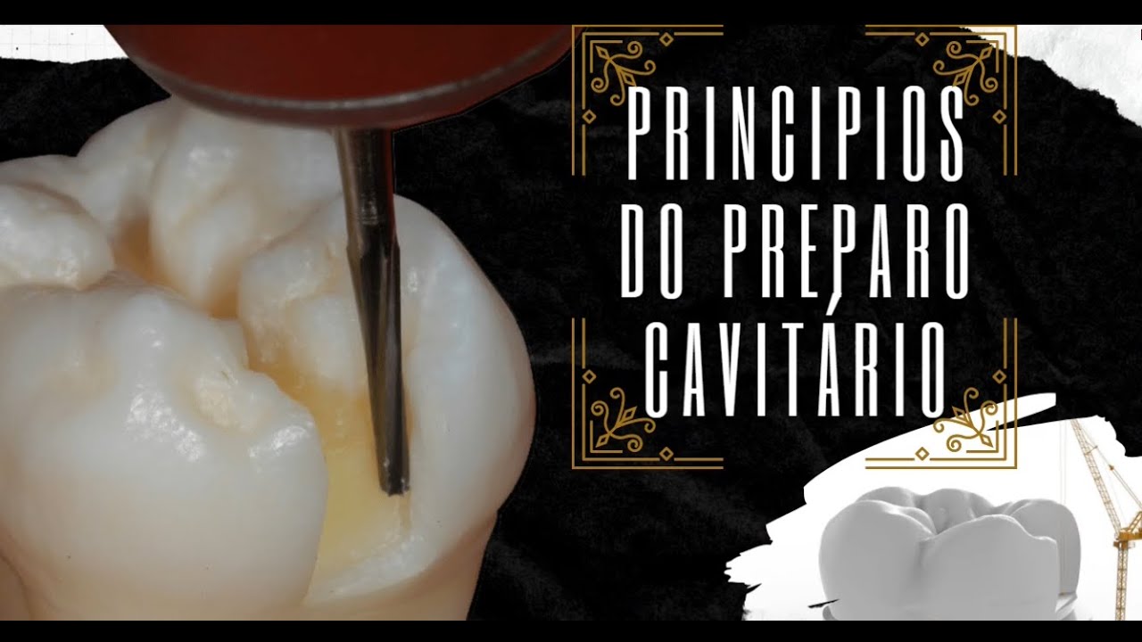 Princípios do Preparo Cavitário