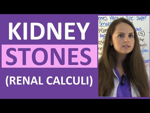 Kidney Stones (Renal Calculi) Nursing Lecture Symptoms, Treatment, Causes NCLEX