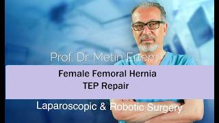 Miniaturka - Female Femoral Hernia. TEP repair. Metin Ertem MD.FACS
