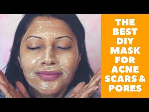 HOW TO MAKE AN AMAZING FACE MASK FOR ACNE SCARS & LARGE PORES | DIY Video