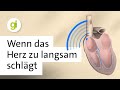 Rhythmusstörung Und Verlangsamter Herzschlag Was Ist Ein AV Block