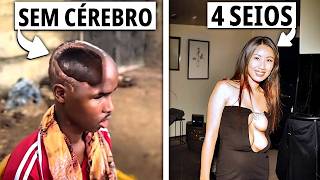 Pessoas Reais Com Corpos Verdadeiramente Únicos