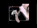 Sparta - Echodyne Harmonic (Track 11 off Wiretap Scars)