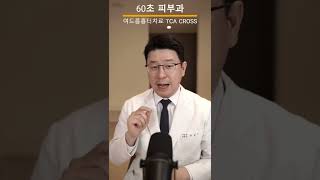여드름흉터치료, 아이스픽 흉터에는 TCA 크로스로 치료해야 합니다