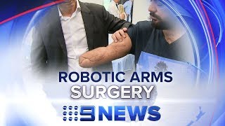 World-first surgery for two robotic arms | Nine News Australia