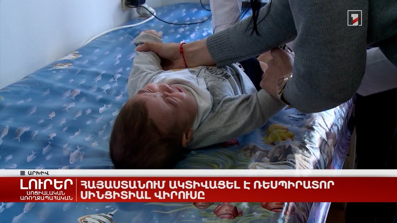 Հայաստանում ակտիվացել է ռեսպիրատոր սինցիտիալ վիրուսը