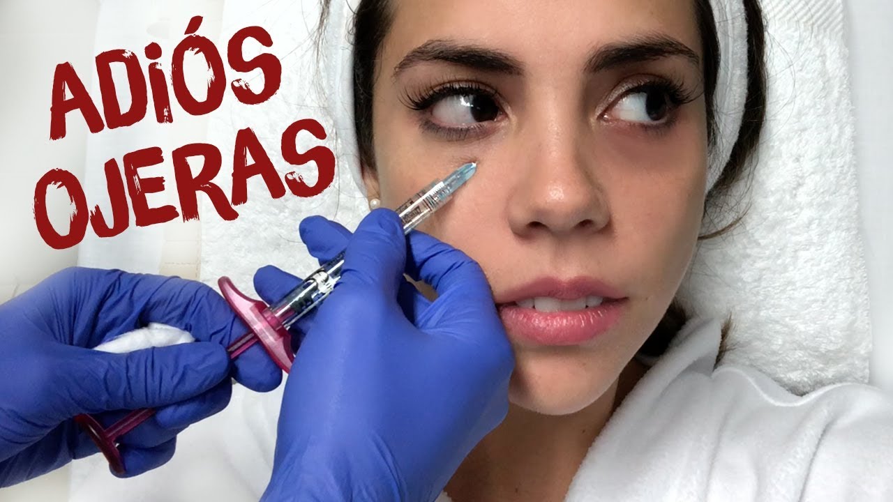 Watch ME HICE LA FAMOSA CIRUGÍA DE OJERAS | What The Chic Now ME HICE LA FAMOSA CIRUGÍA DE OJERAS | What The Chic