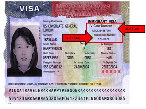 Dos Case Id On Green Card