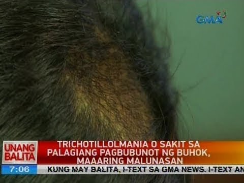 Zelenko kuko halamang-singaw paggamot review Folk remedyo laban kuko halamang-singaw at paa
