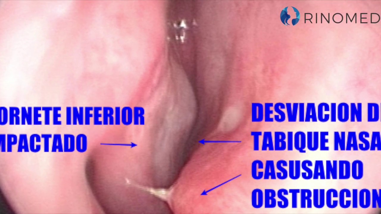 Lino Lara Solórzano-10