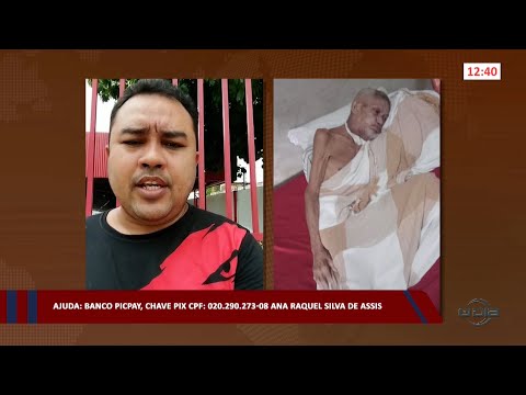 Idoso pede ajuda para tratamento especial devido a câncer de boca 14 03 2023