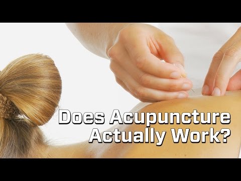 Junk Science Episode 11: Acupuncture