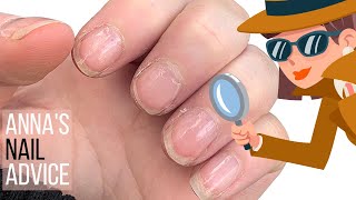 Is Builder Gel good for damaged nails? [Anna
