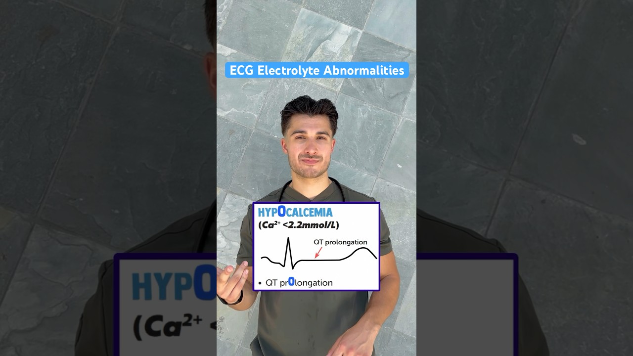 Easy trick for ECG Electrolyte Abnormalities 📈 #medstudent #medschool #usmle #cardiology #ecg