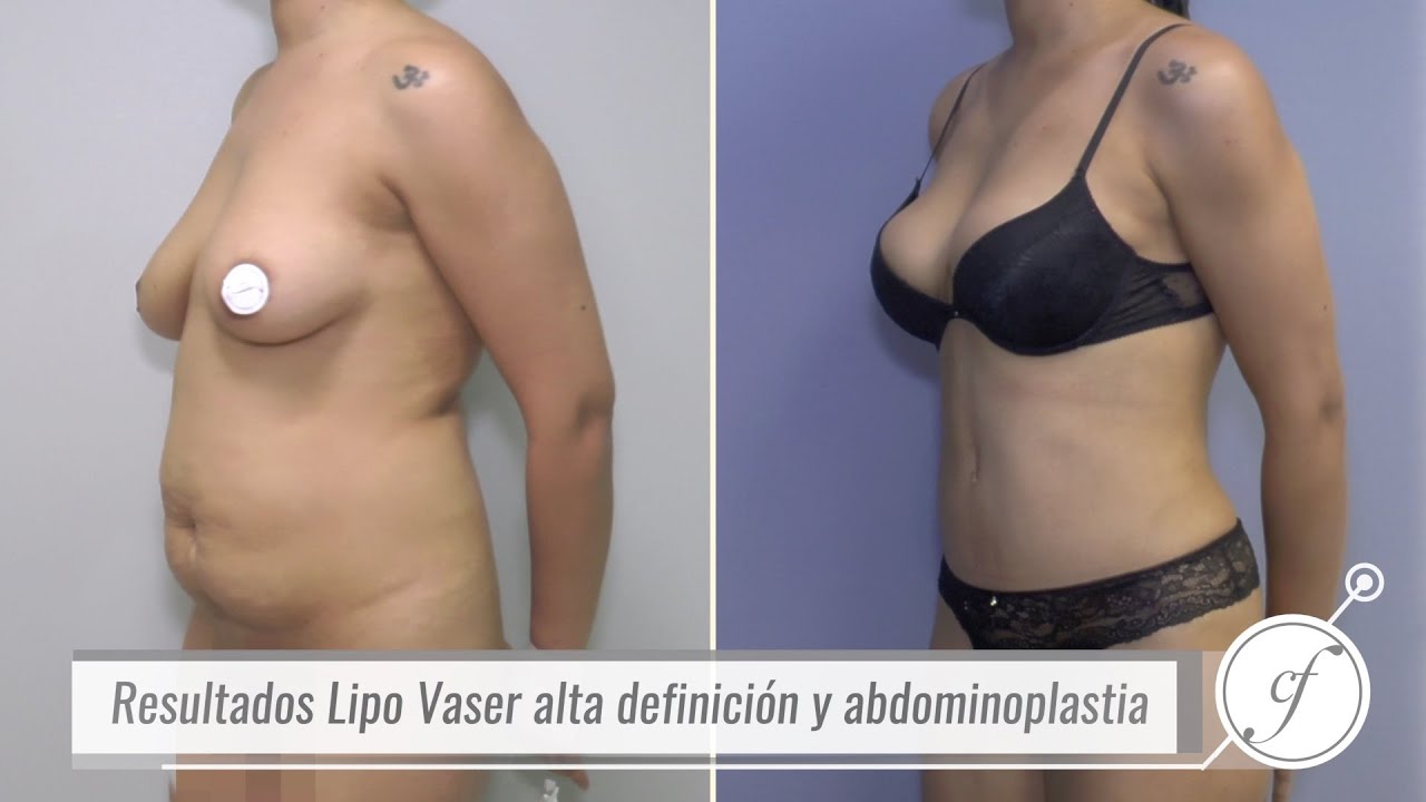 Eduardo Forcada Melero-38