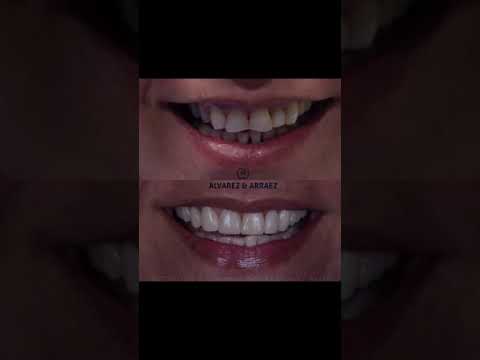 video zpmN64VcMsk