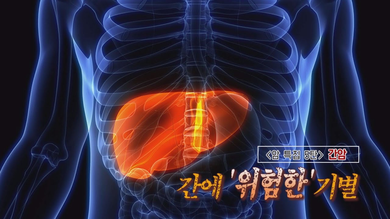 <특별기획> 치료를 넘어 치유로 5편 간암 | 소화기내과 장병국, 간담췌외과 김태석 교수 관련사진