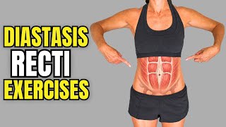 Diastasis Recti Exercises: 3 Proven Ways to Strengthen Your Core