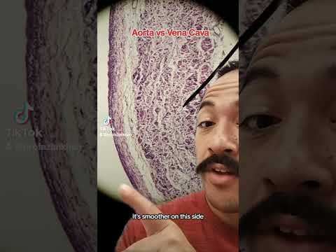 Aorta vs. vena cava