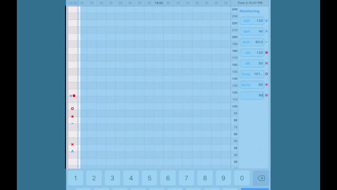 TUTORIAL: The SmartFlow Electronic Anesthetic Sheet