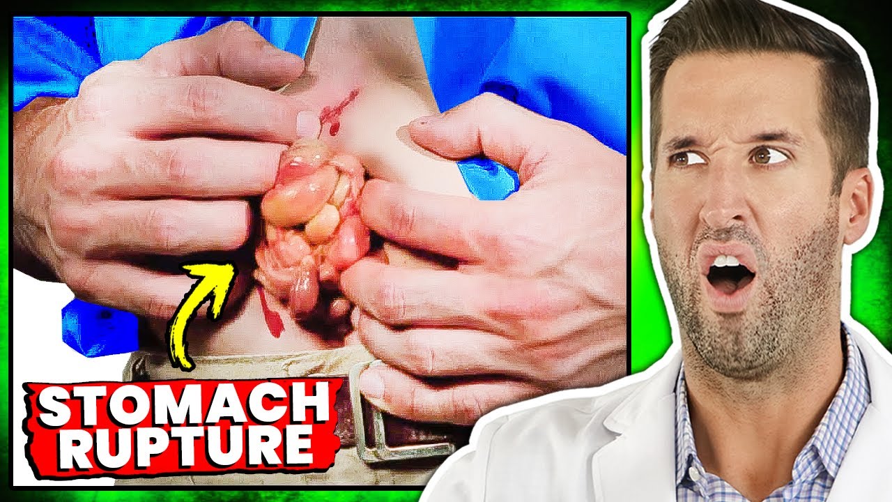 How Much Food Can Your Stomach Hold? | Reacting to Your Medical Questions