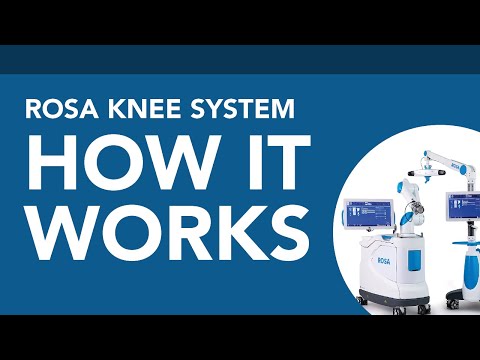 ROSA Knee System - How It Works