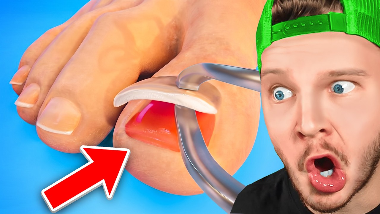 Miniature Vidéo 1