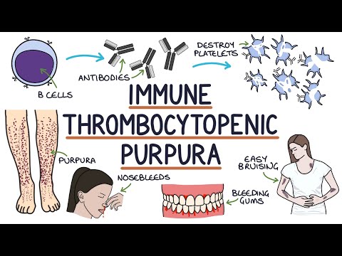 Understanding Immune Thrombocytopenic Purpura - ITP