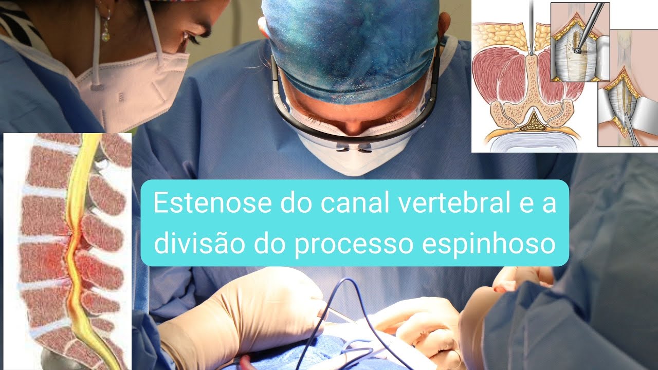 Marco Aurélio Severo Da Silva Versiani-77