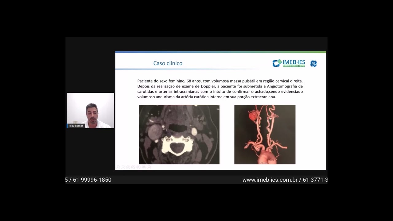 Protocolos de Angiografia por Tomografia Computadorizada | GE HealthCare Brasil