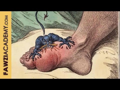 Erkrankungen des Schultergelenks Tendinitis Rückenschmerzen tauben Beine