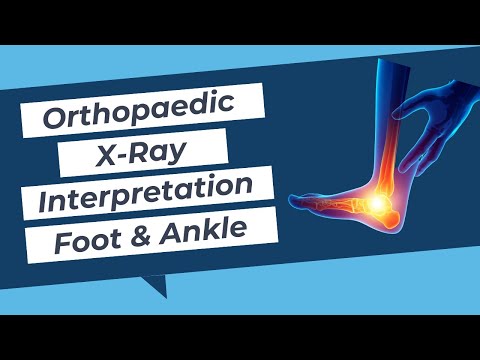 Ortopedyczna interpretacja rentgenowska - stopa i kostka