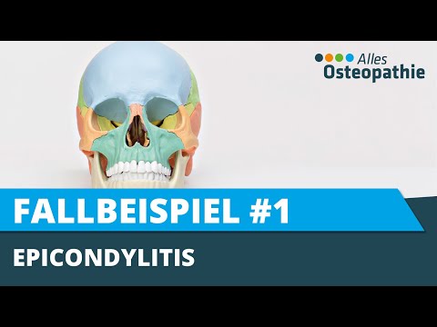 Tennisellenbogen, Golferellenbogen - Epicondylitis aus osteopathischer Sicht