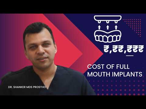 What is the Cost of Full Mouth Implants?