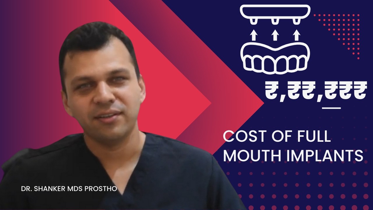 What is the Cost of Full Mouth Implants?